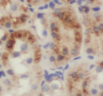 TRAPPC9 Mouse Monoclonal Antibody