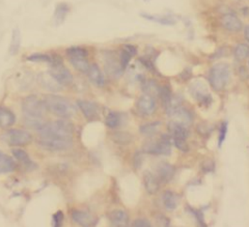 TRPC4AP Antibody