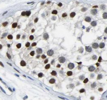 CEP41 Rabbit Polyclonal Antibody