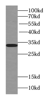 TST Mouse Monoclonal Antibody