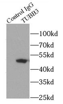 Beta Tubulin Antibody