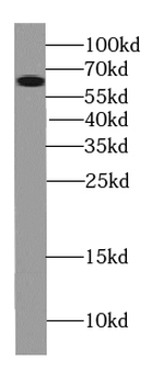 TWNK Rabbit Polyclonal Antibody