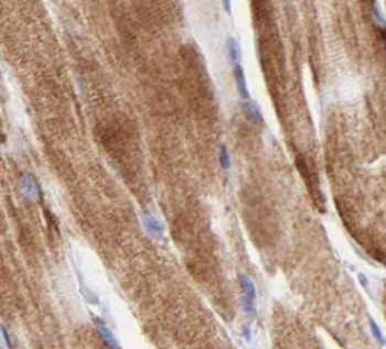 TWNK Rabbit Polyclonal Antibody