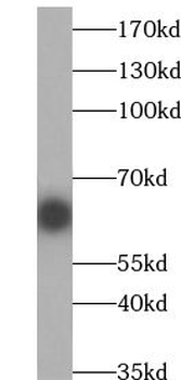 TWNK Rabbit Polyclonal Antibody