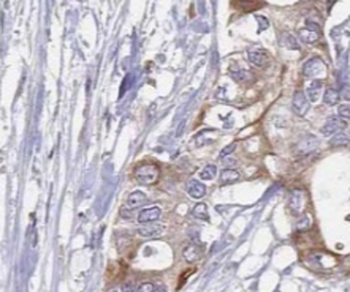 TWNK Rabbit Polyclonal Antibody