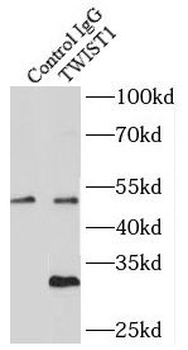 TWIST1 Antibody