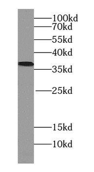 PLAUR Antibody