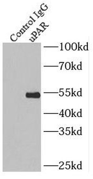PLAUR Antibody