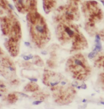 UQCR11 Rabbit Polyclonal Antibody