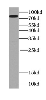 VRTN Rabbit Polyclonal Antibody
