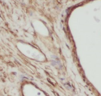 VRTN Rabbit Polyclonal Antibody