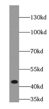 VWA1 Rabbit Polyclonal Antibody