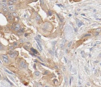 VWA1 Rabbit Polyclonal Antibody