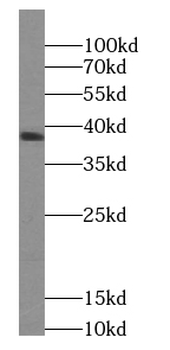 WNT5A B Rabbit Polyclonal Antibody