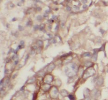 WNT5A B Rabbit Polyclonal Antibody