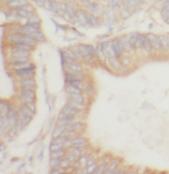 YES1 Specific Rabbit Polyclonal Antibody