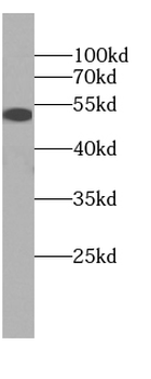 DAPK3 Rabbit Polyclonal Antibody