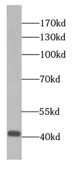 SLC30A3 Rabbit Polyclonal Antibody