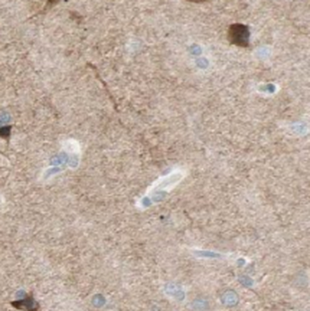 SLC30A3 Rabbit Polyclonal Antibody
