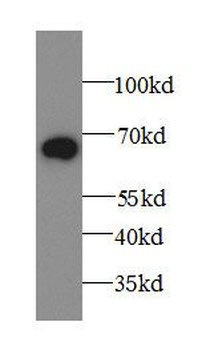 A1BG Rabbit Polyclonal Antibody