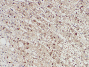 A1BG Rabbit Polyclonal Antibody