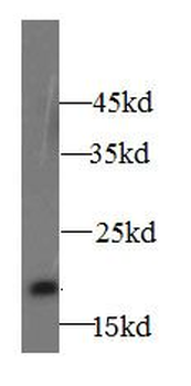 GGACT Rabbit Polyclonal Antibody