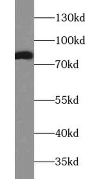 AACS Rabbit Polyclonal Antibody