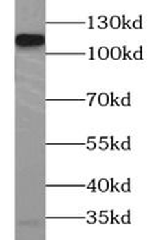 AARS2 Rabbit Polyclonal Antibody