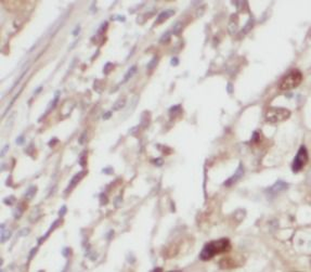 AARS2 Rabbit Polyclonal Antibody