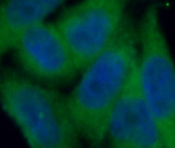 ABCA2 Rabbit Polyclonal Antibody