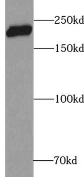 ABCA7 Rabbit Polyclonal Antibody