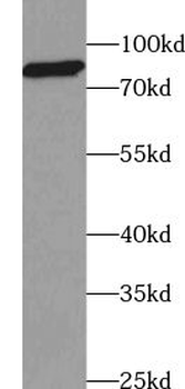 ABCB9 Rabbit Polyclonal Antibody
