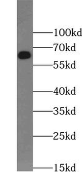 ABCE1 Rabbit Polyclonal Antibody