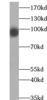 ABCF1 Antibody