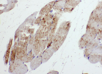 ABHD5 Rabbit Polyclonal Antibody
