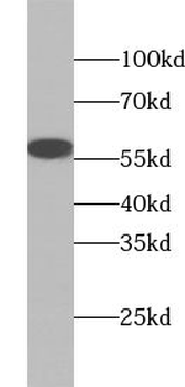 ABI2 Rabbit Polyclonal Antibody