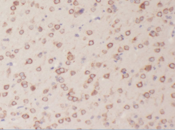 ABI2 Rabbit Polyclonal Antibody