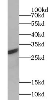 ABT1 Rabbit Polyclonal Antibody