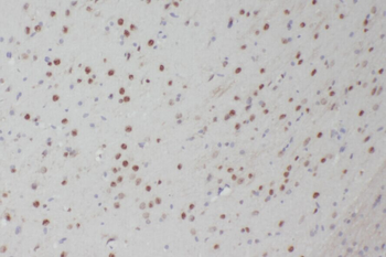 ABT1 Rabbit Polyclonal Antibody