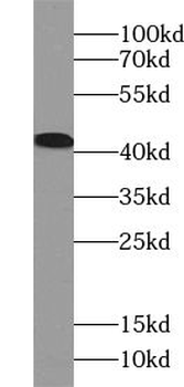 ACAA2 Rabbit Polyclonal Antibody
