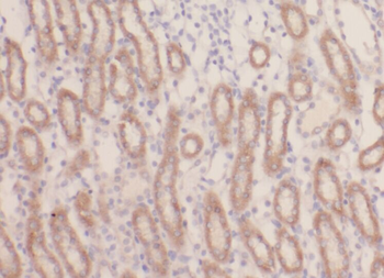 ACADL Antibody