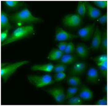 ACADS Rabbit Polyclonal Antibody