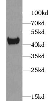 ACADS Rabbit Polyclonal Antibody