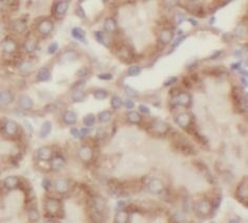 ACADS Rabbit Polyclonal Antibody