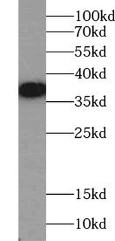 ACBD4 Rabbit Polyclonal Antibody