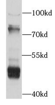 ACOX1 Rabbit Polyclonal Antibody