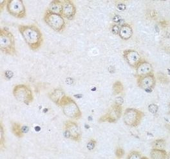 ACOX1 Rabbit Polyclonal Antibody
