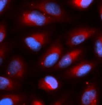 ACP5 Rabbit Polyclonal Antibody