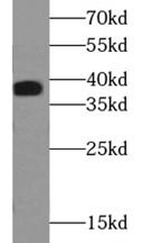ACP5 Rabbit Polyclonal Antibody