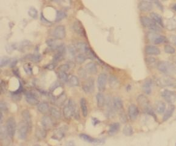 ACP5 Rabbit Polyclonal Antibody